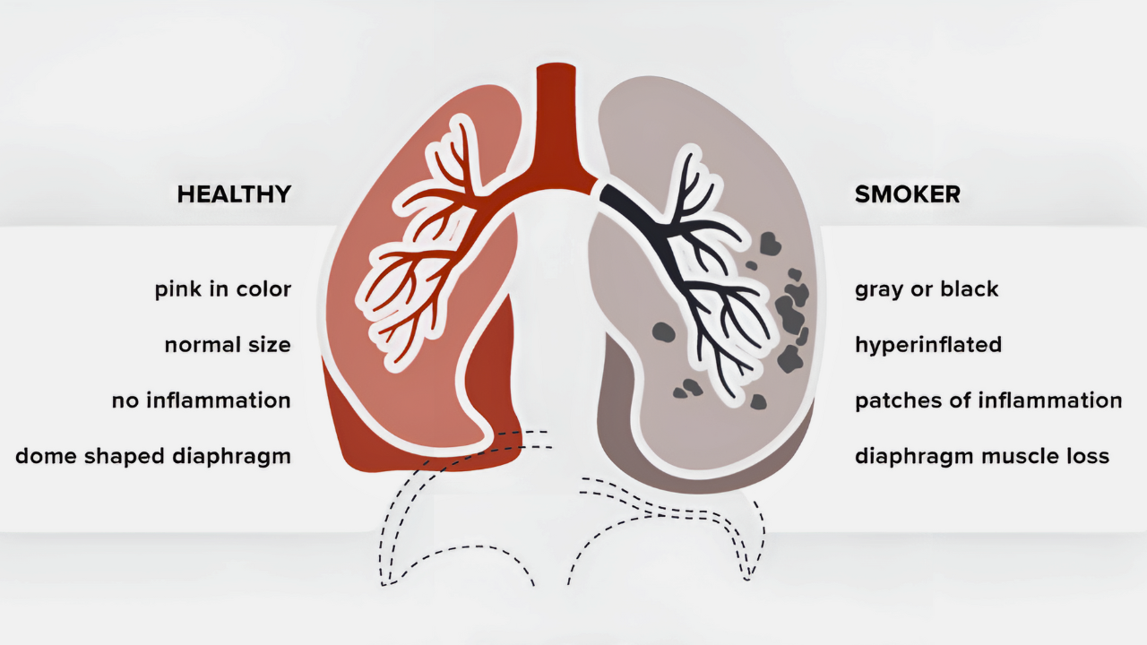 unhealthy lungs signs